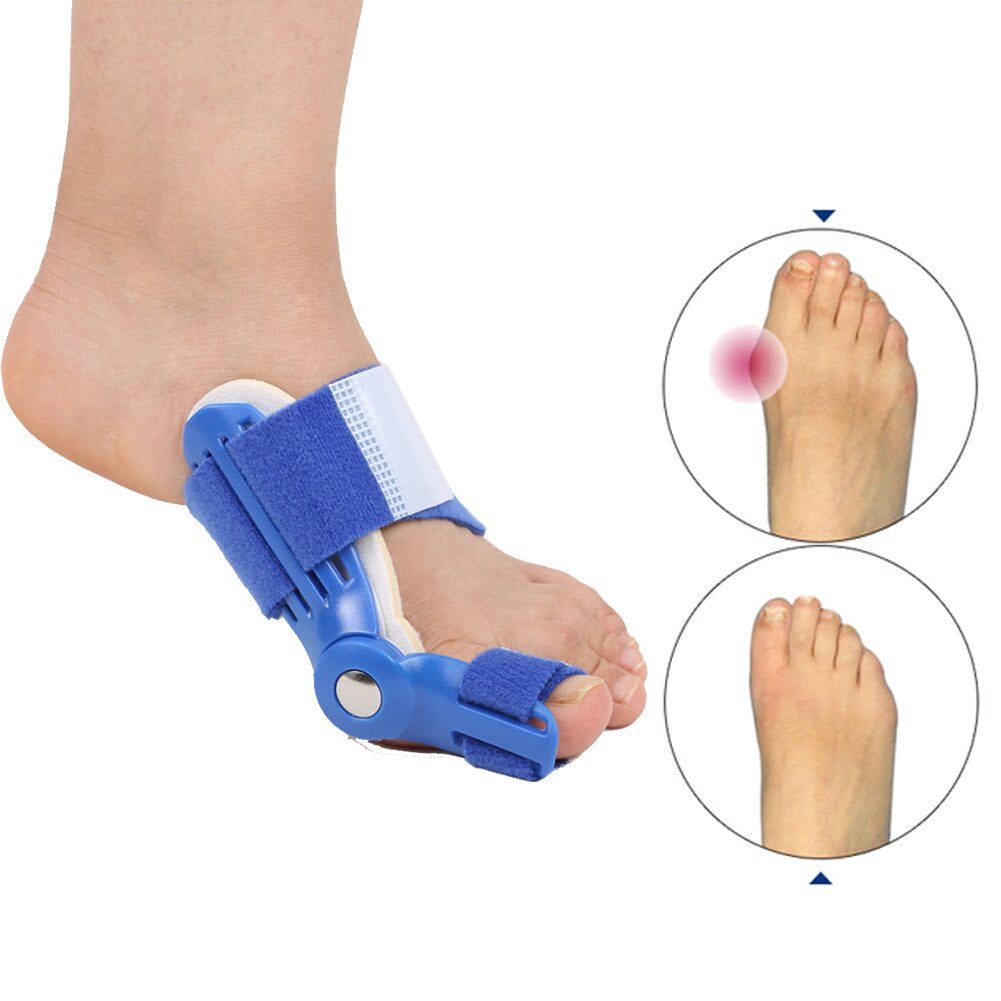 Korrekturschiene für Hallux Valgus (1 Paar) - BunionFix