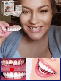 Flexible Denture Set for Upper & Lower Jaw – Reusable & Custom-Fit 5
