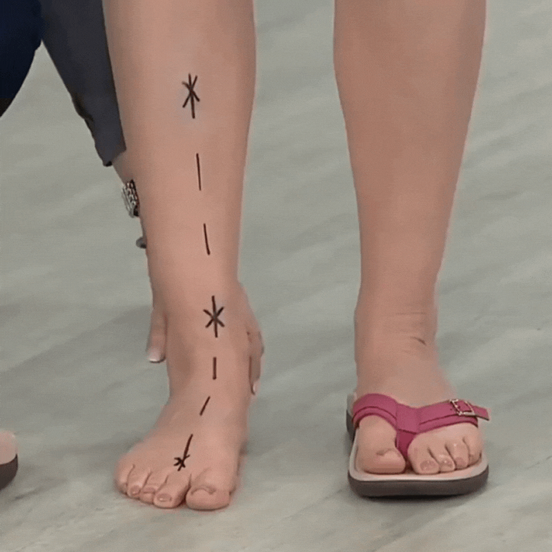 Benen van een model met getekende lijnen op de voet en roze teensandaal rechts 1
