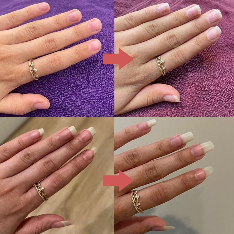 Twee voor-en-nafoto's van een hand met ring waarop de nagels langer en verzorgder zijn geworden 9