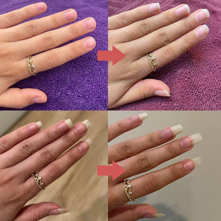 Twee voor-en-nafoto's van een hand met ring waarop de nagels langer en verzorgder zijn geworden 9