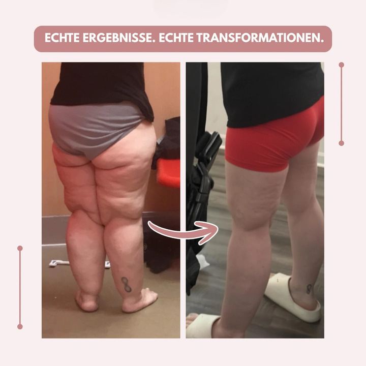 Voor-en-nabeeld van de benen van achteren: links zonder legging, rechts met aansluitende kleding, met pijl ertussen en Duitse tekst. 10