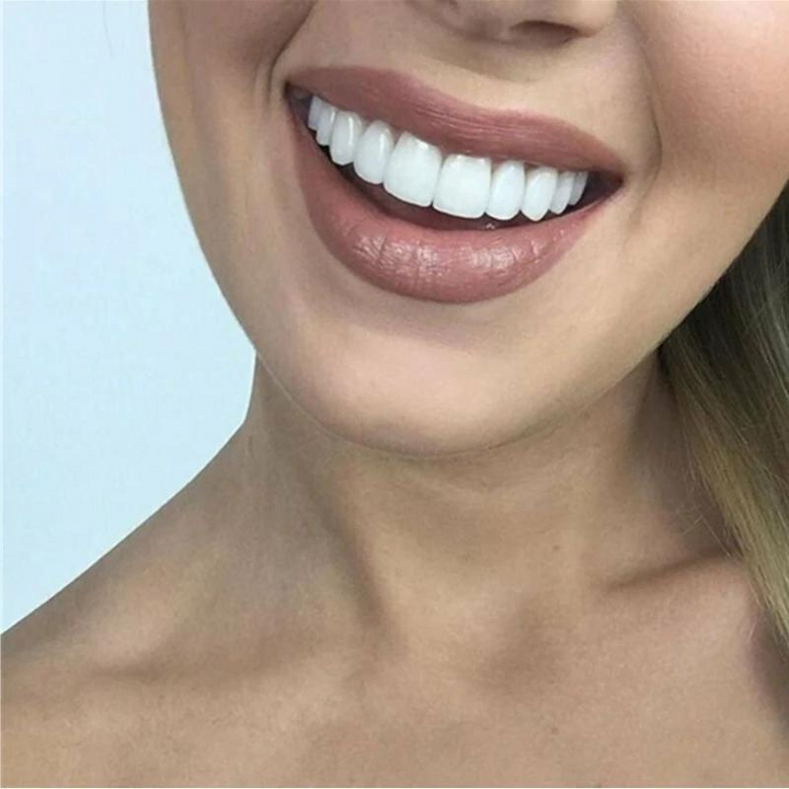 Close-up van een lachende vrouw met egale, stralend witte tanden, bruinroze lippenstift en blond haar. 3