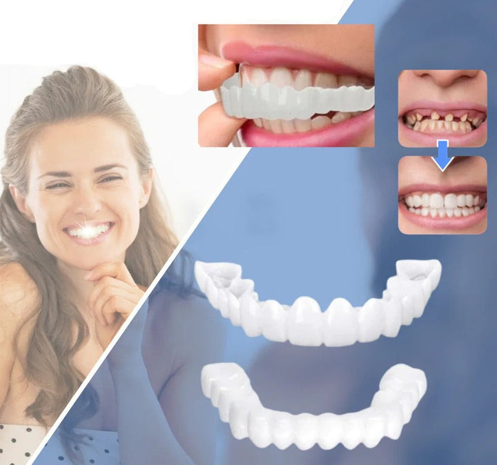 Snap-On Veneers | Flexible No-Glue Fit for Meals and Daily Wear 6