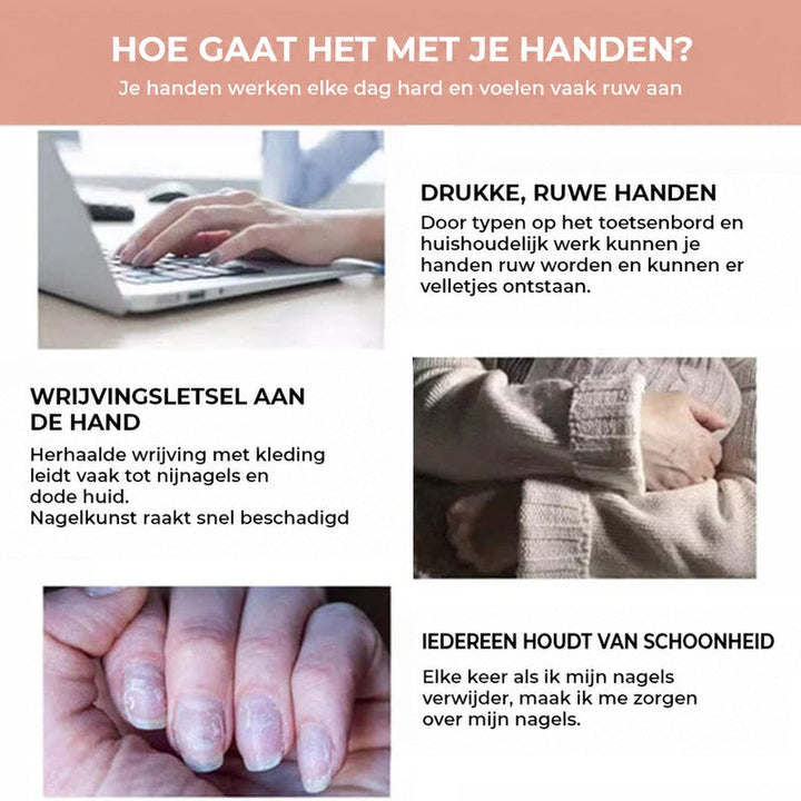 Drie situaties die handen ruw maken: typen op een laptop, wrijving met kleding en beschadigde nagels 6