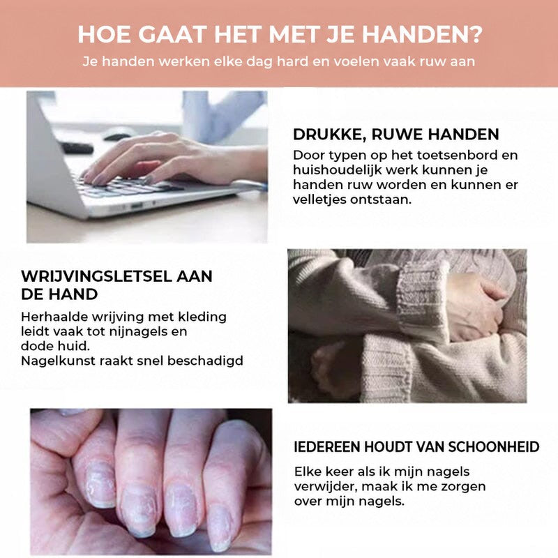 Drie situaties die handen ruw maken: typen op een laptop, wrijving met kleding en beschadigde nagels 6