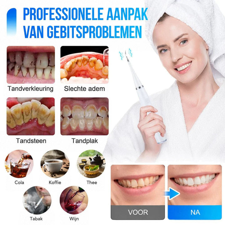 Collage met tandvlekken, tandsteen en plaque, koffie, thee en wijn als oorzaken, plus voor-en-nafoto van tanden en een vrouw met de witte reiniger. 2