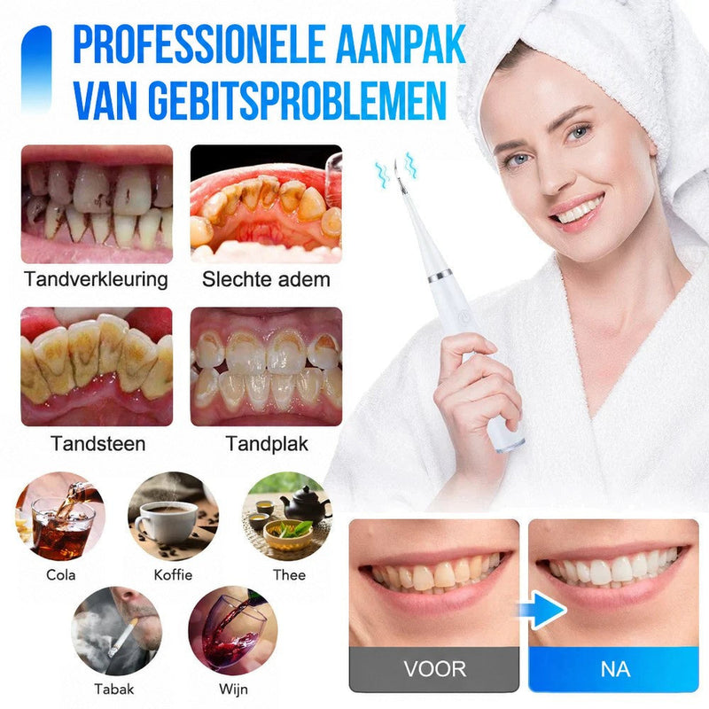 Collage met tandvlekken, tandsteen en plaque, koffie, thee en wijn als oorzaken, plus voor-en-nafoto van tanden en een vrouw met de witte reiniger. 2
