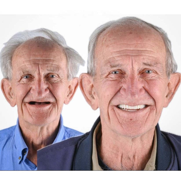 Voor-en-nafoto van een oudere man: links zonder voortanden, rechts glimlachend met een complete rij witte tanden. 6
