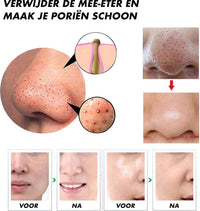 ClearFace™: Poriënreiniger