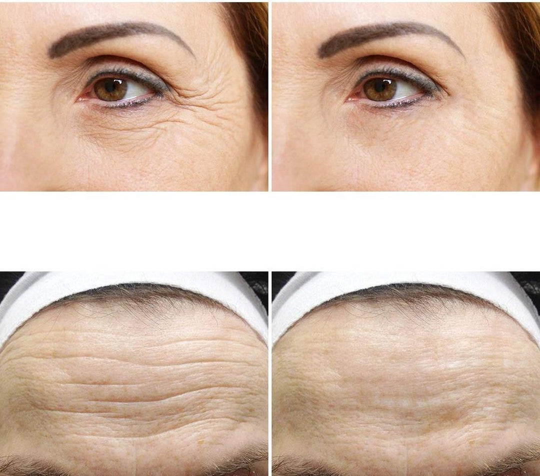 AntiAge: Siliconen Rimpel Pads