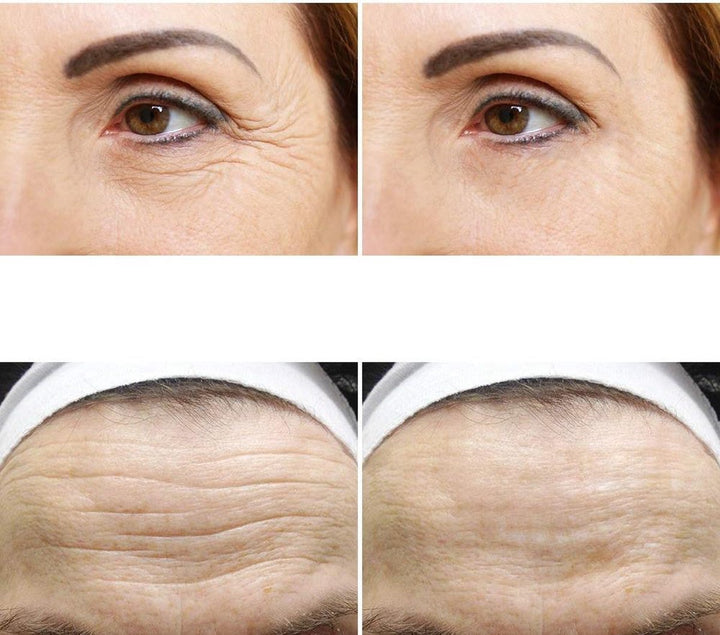 AntiAge: Siliconen Rimpel Pads