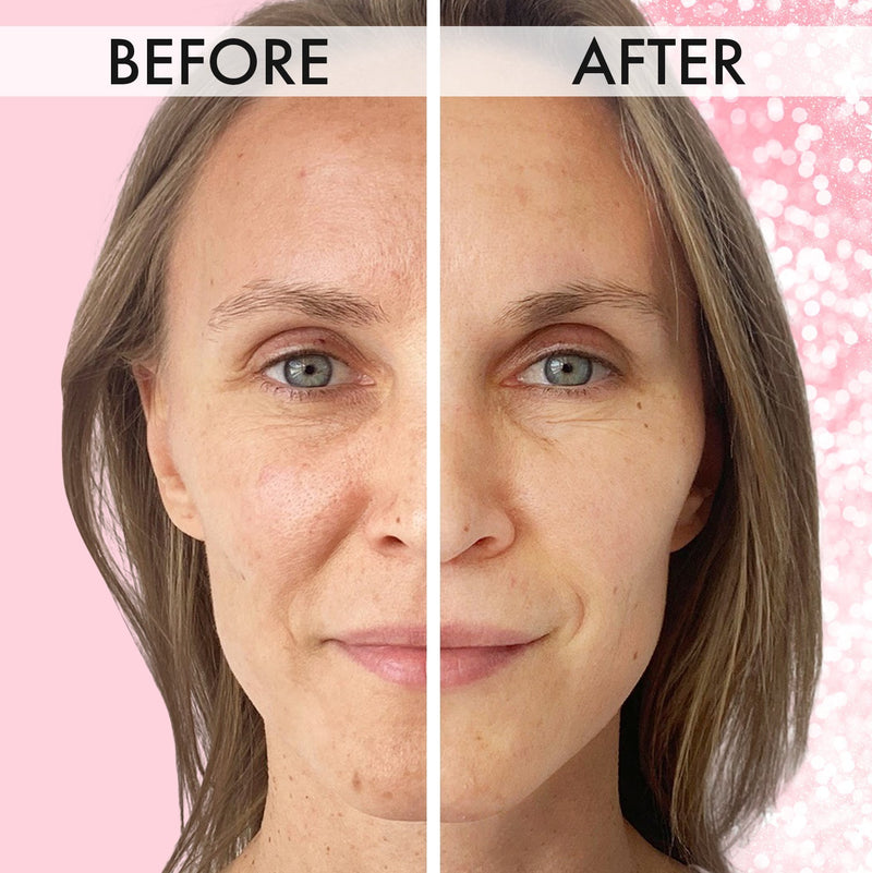 Facial Massage Roller™