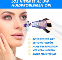 ClearFace™: Poriënreiniger