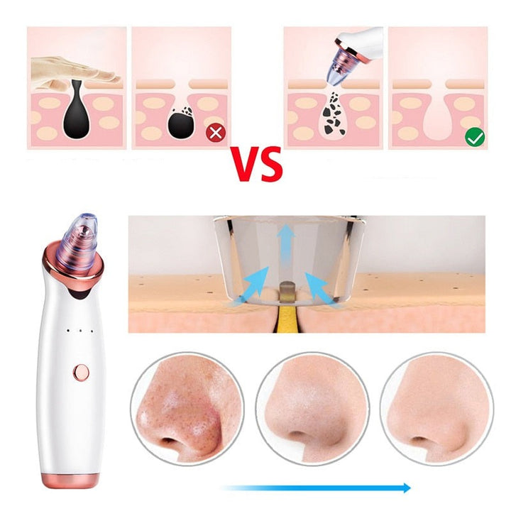 Pore Cleaner | Huid Reiniginger