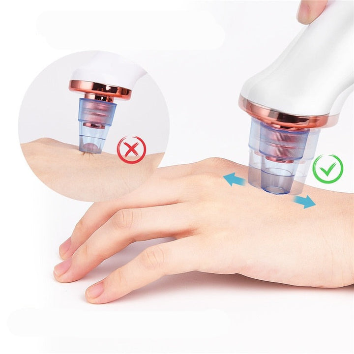 Pore Cleaner | Huid Reiniginger