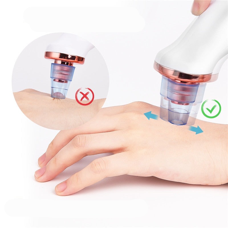 Pore Cleaner | Huid Reiniginger