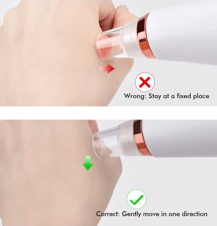 Pore Cleaner | Huid Reiniginger